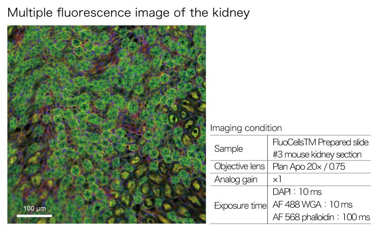 Measurement Examples: mouse kidney